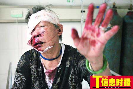 广州7天发生5起精神病人伤害亲人及路人事件
