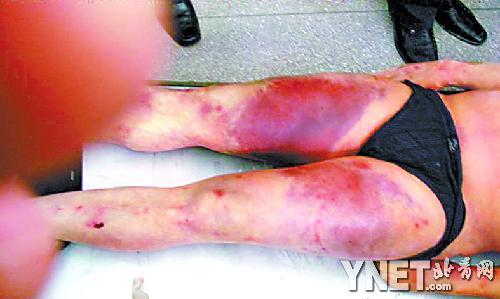 江苏赣榆前供电局副局长死在县检察院 尸检有